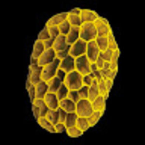 Meet your Posher, Devon